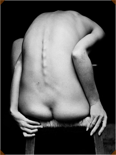 by Jack Welpott